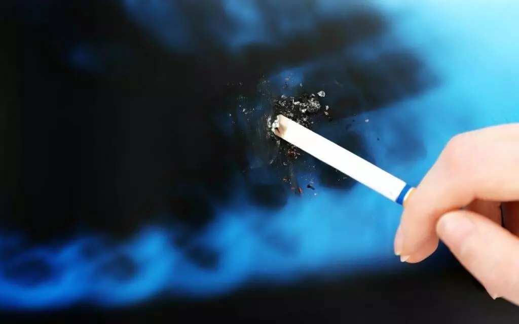 smoking-may-have-caused-the-need-for-tooth-extraction-Bradford-Dentist