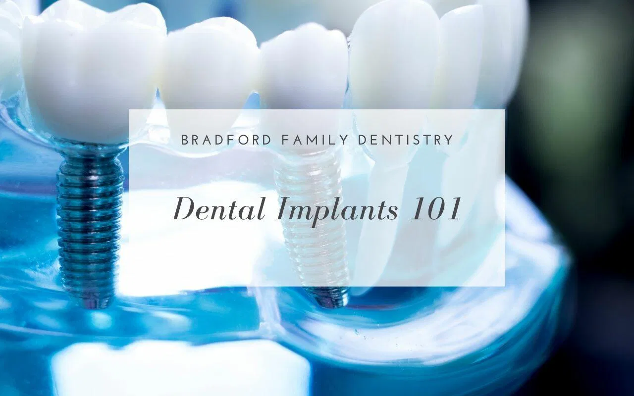 Dental Implants 101 - Bradford Family Dentistry