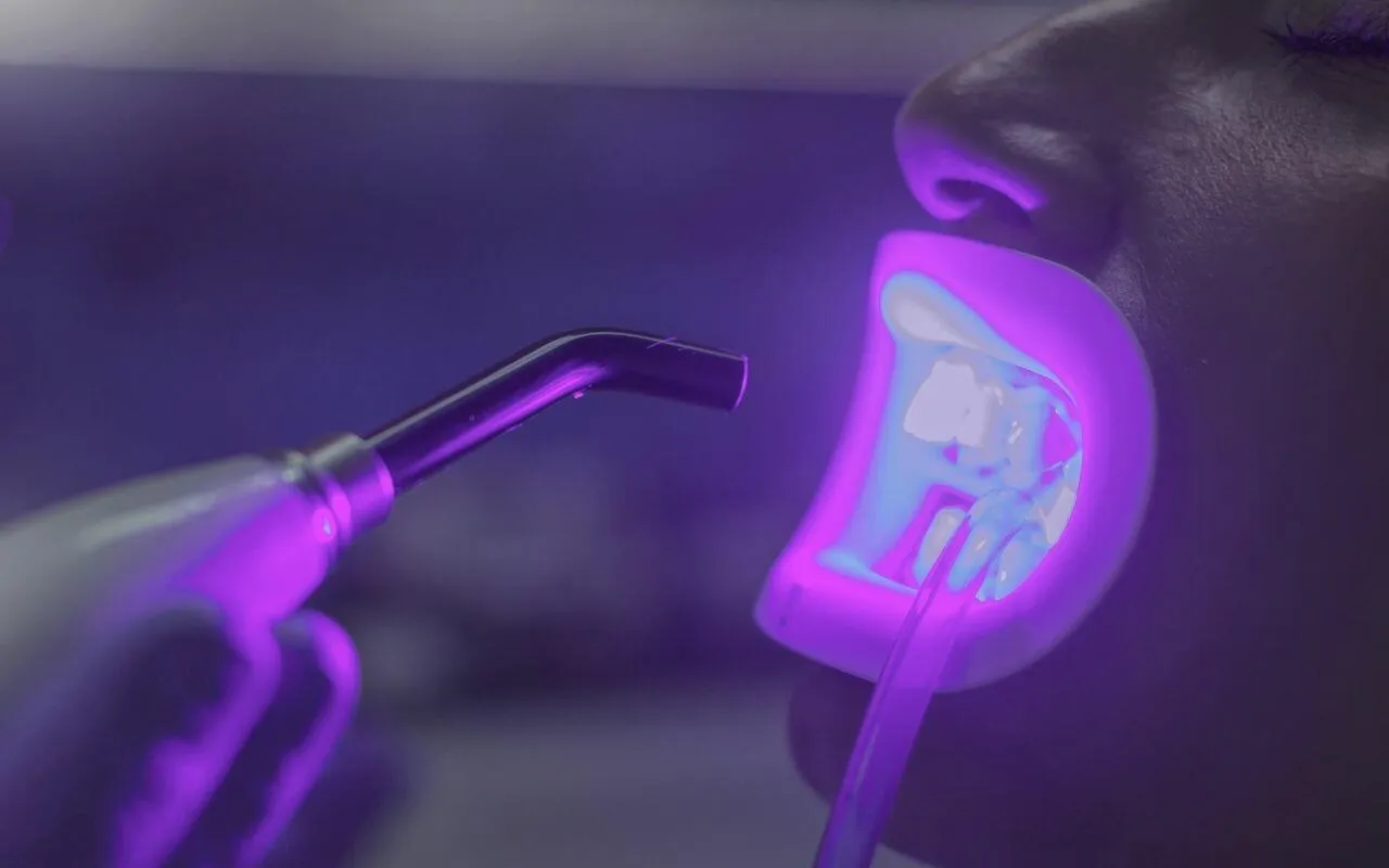 how does Zoom teeth whitening work Bradford Dentist Bradford Family Dentistry