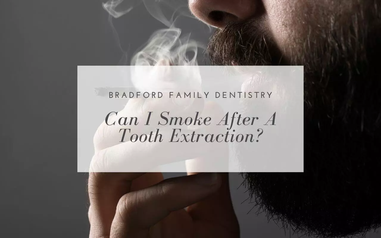 Can I Smoke After A Tooth Extraction Bradford Family Dentistry 