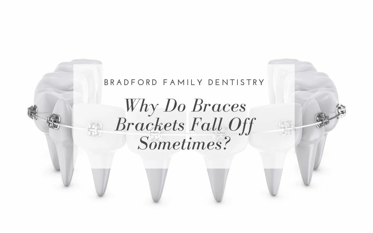 Why Do Braces Brackets Fall Off Sometimes? Bradford Family Dentistry