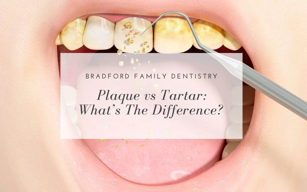 Plaque vs Tartar What’s The Difference? Bradford Family Dentistry