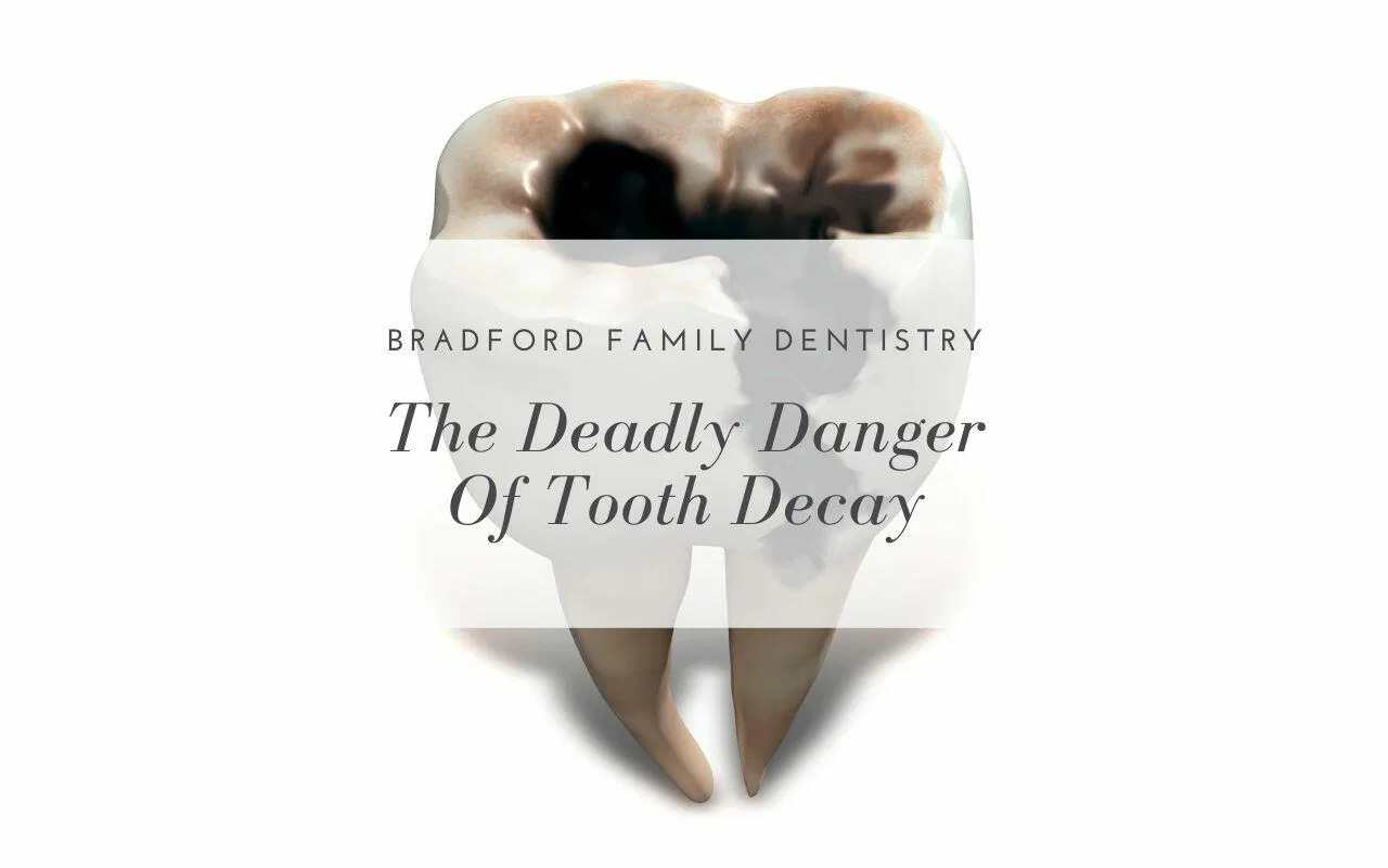 the deadly danger of tooth decay - Bradford Family Dentistry - Bradford ...