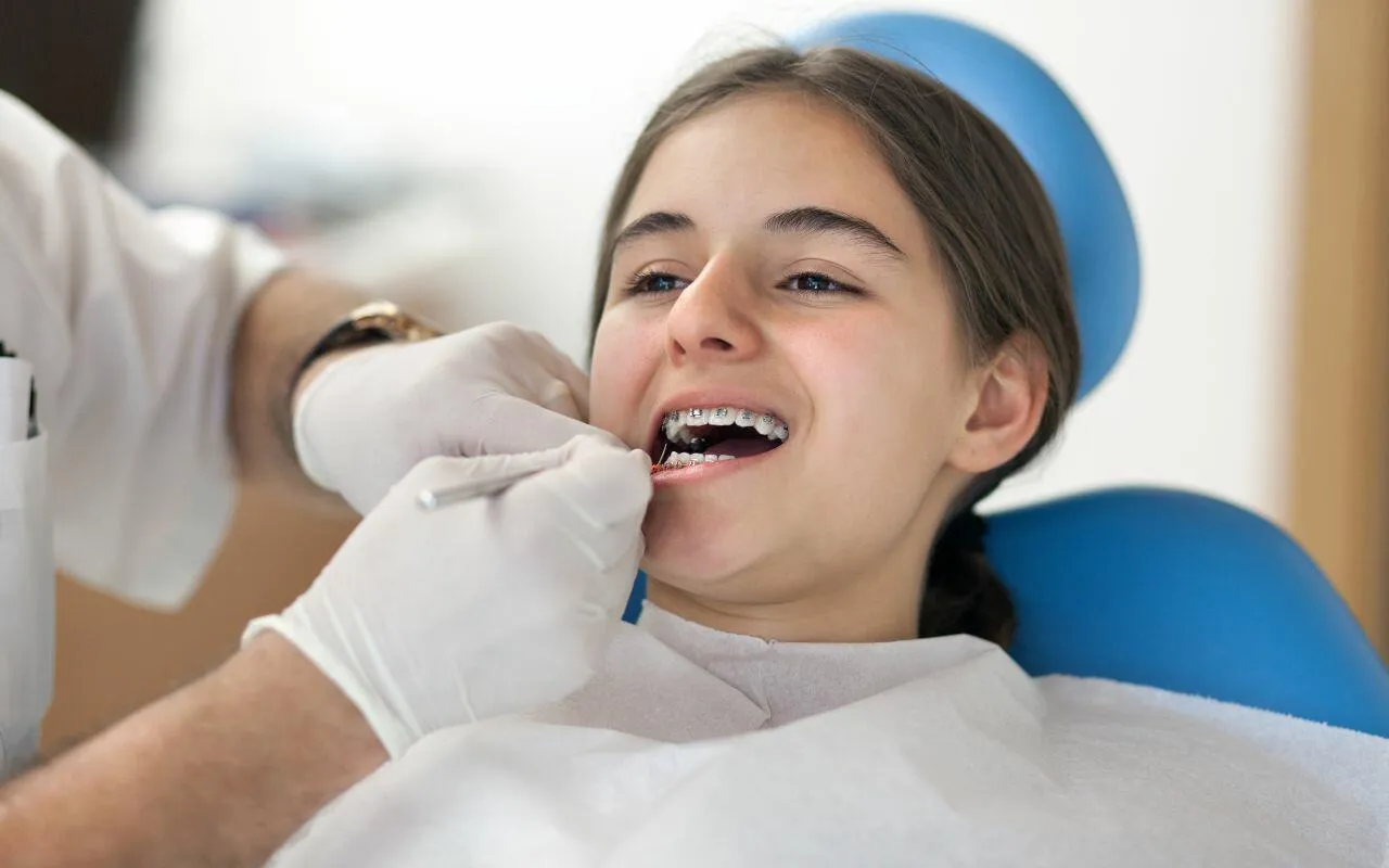 Why Do Braces Brackets Fall Off Sometimes? Bradford Family Dentistry
